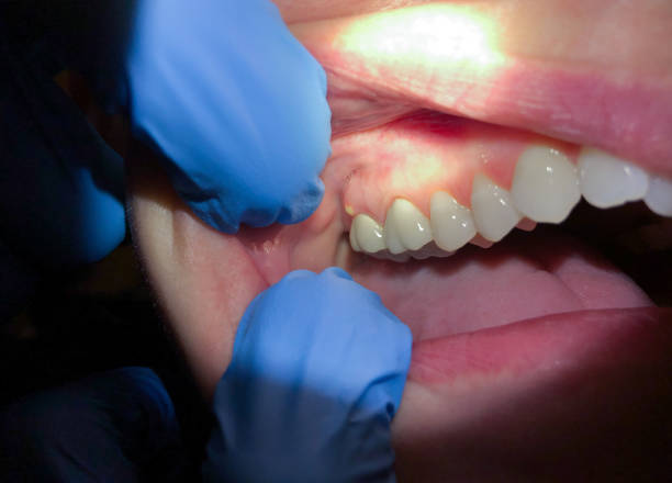 Best Urgent Dental Care for Toothaches in Dolgeville, NY
