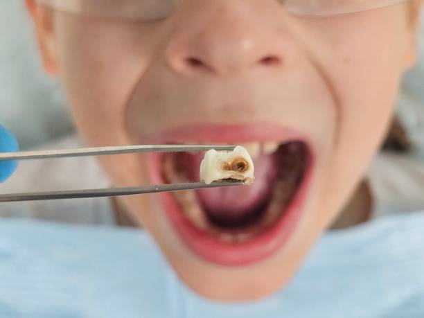 Best Walk-In Emergency Dental Services in Dolgeville, NY